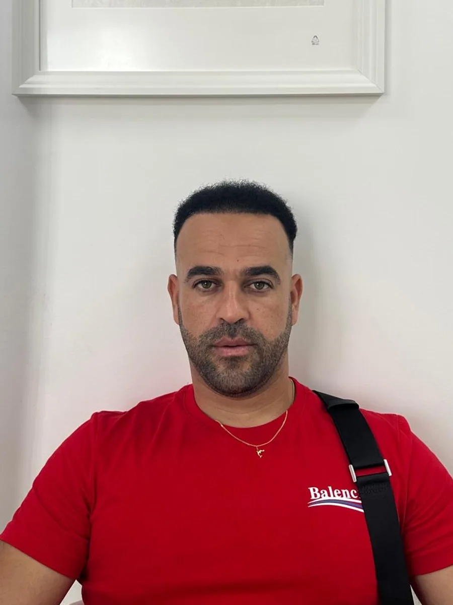 After hair restoration