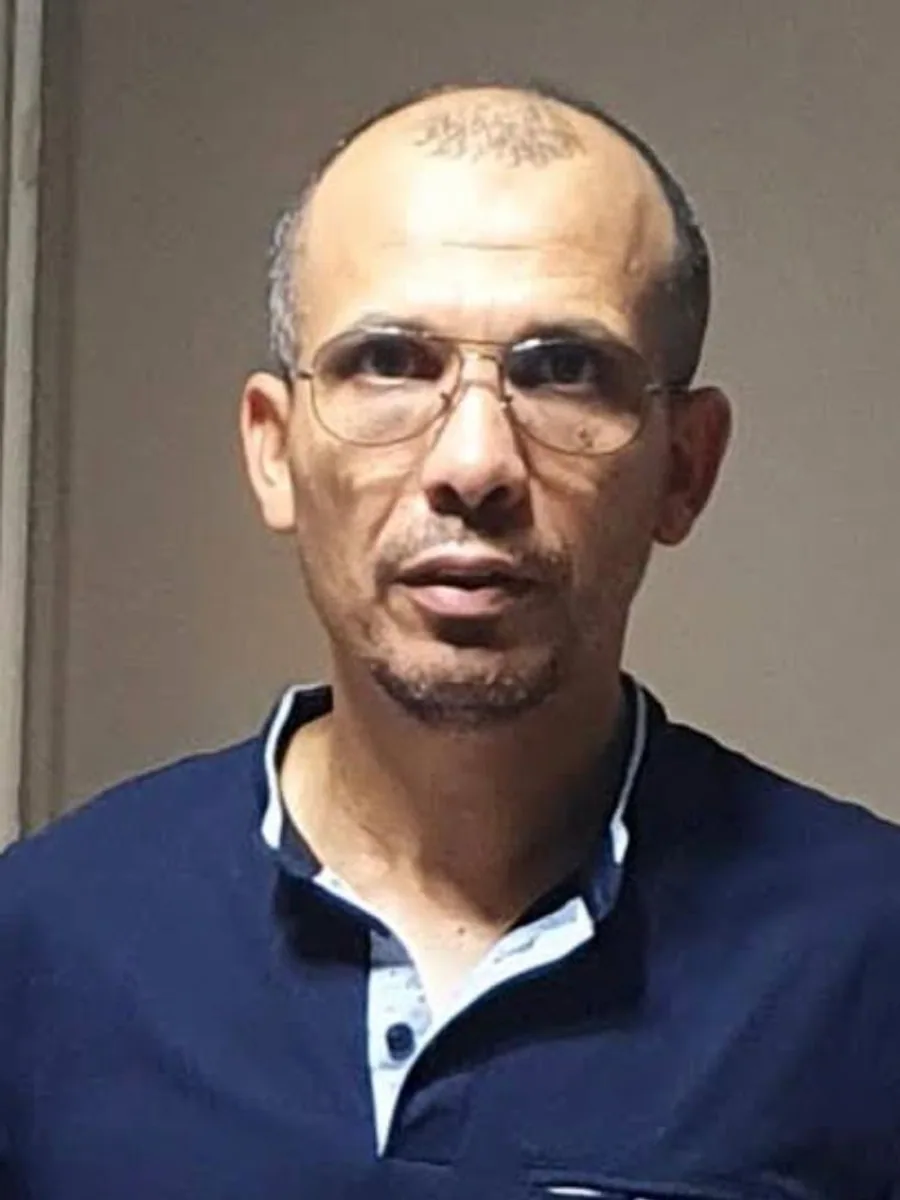 Before hair restoration