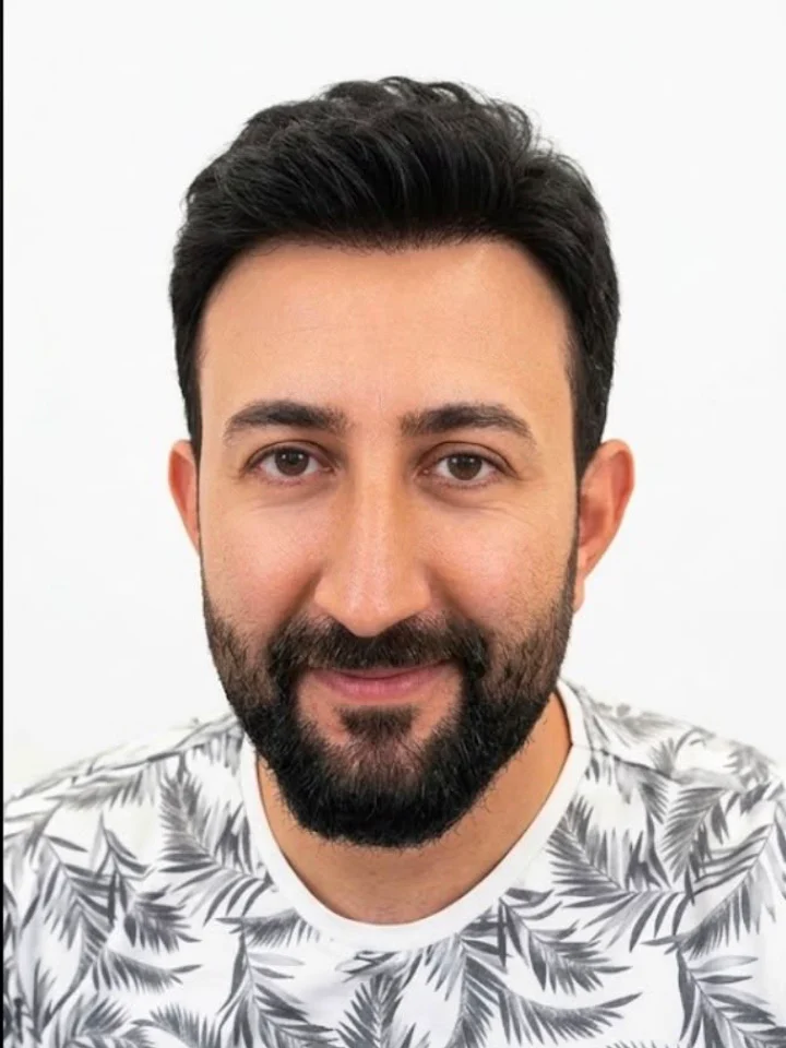 After hair restoration