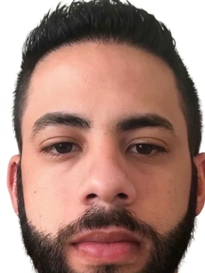After hair restoration